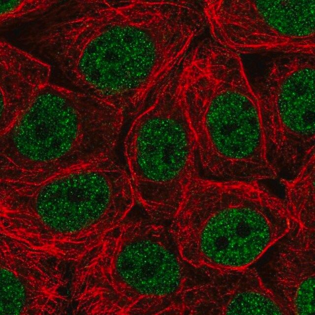 Anti-CHTF18 antibody produced in rabbit