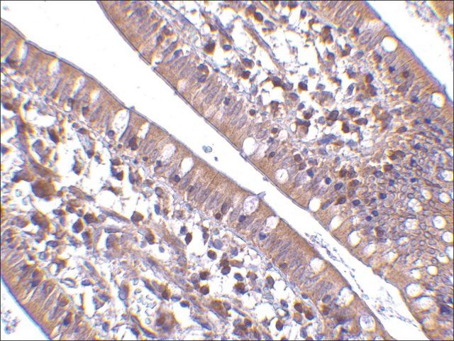 Anti-CIDE-B (ab2) antibody produced in rabbit