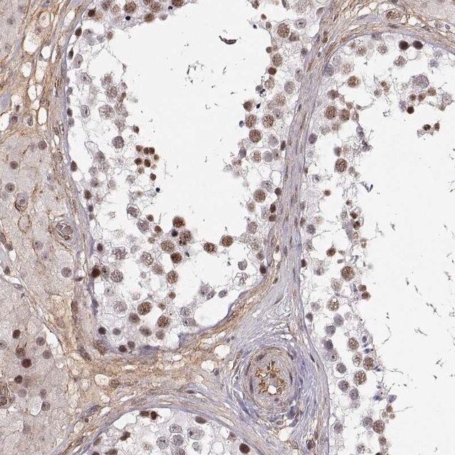 Anti-CIR1 antibody produced in rabbit