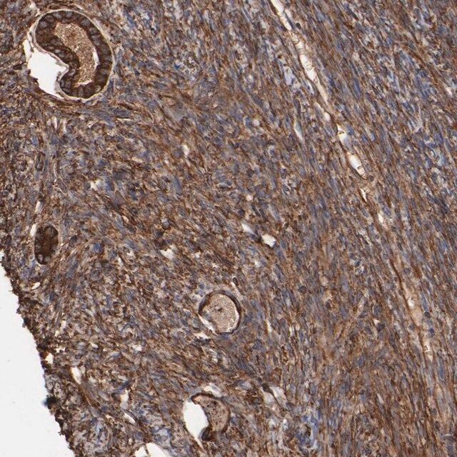 Anti-CILP antibody produced in rabbit