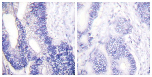 Anti-Claudin 3 antibody produced in rabbit