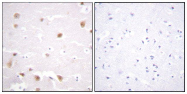 Anti-CKII- antibody produced in rabbit