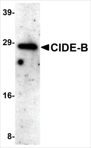 Anti-CIDE-B (ab3) antibody produced in rabbit