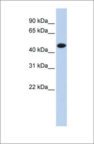 Anti-CKM (ab1) antibody produced in rabbit