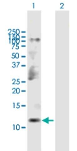 Anti-CKS2 antibody produced in mouse