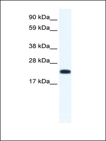 Anti-CITED4 antibody produced in rabbit