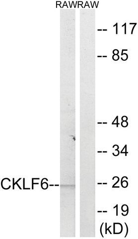 Anti-CKLF6 antibody produced in rabbit