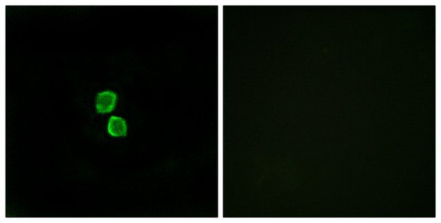 Anti-CKLF1 antibody produced in rabbit