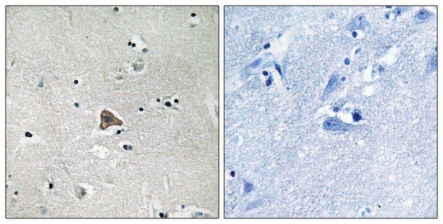 Anti-Claudin 4 antibody produced in rabbit