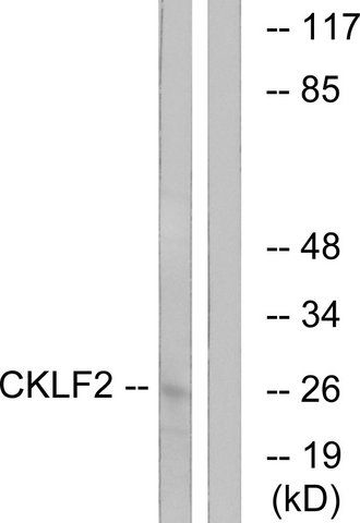 Anti-CKLF2 antibody produced in rabbit