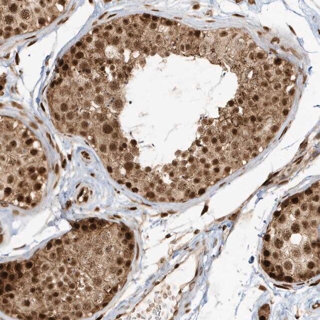 Anti-CKS2 antibody produced in rabbit