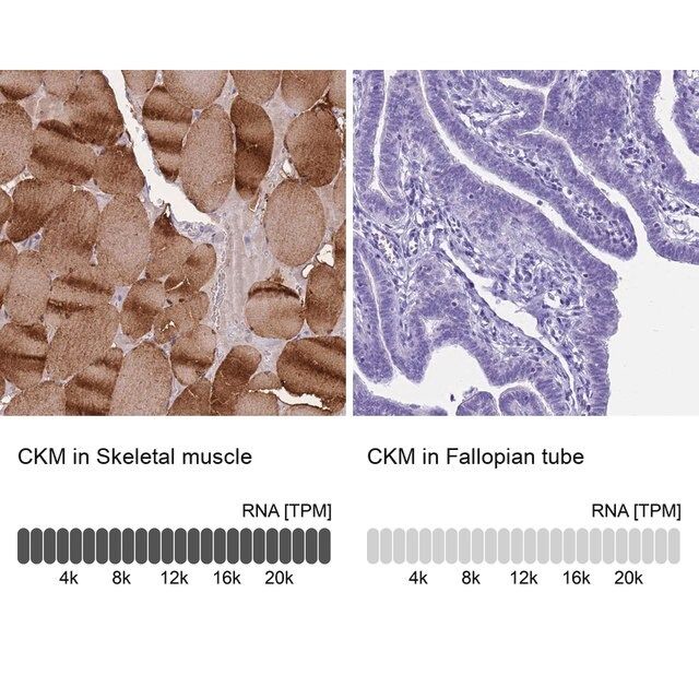 Anti-CKM antibody produced in rabbit