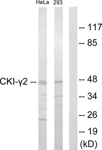 Anti-CKI-2 antibody produced in rabbit