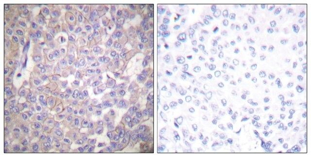 Anti-Claudin 2 antibody produced in rabbit