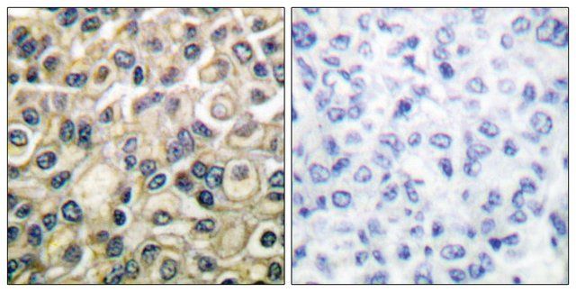 Anti-Claudin 1 antibody produced in rabbit