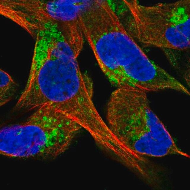 Anti-CLCN5 antibody produced in rabbit