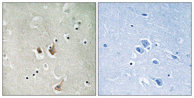 Anti-CKS2 antibody produced in rabbit