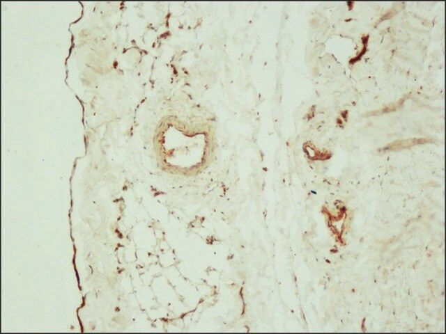 Anti-Claudin-5 antibody produced in rabbit