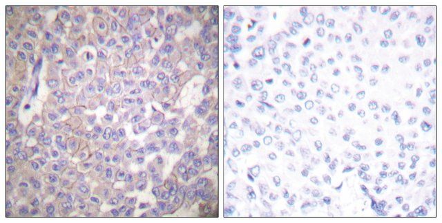 Anti-Claudin 2 antibody produced in rabbit