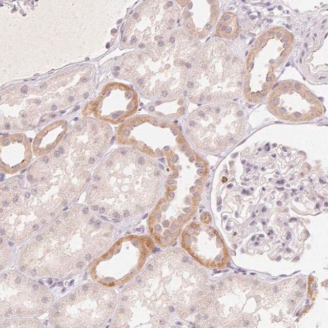 Anti-CLCNKA antibody produced in rabbit