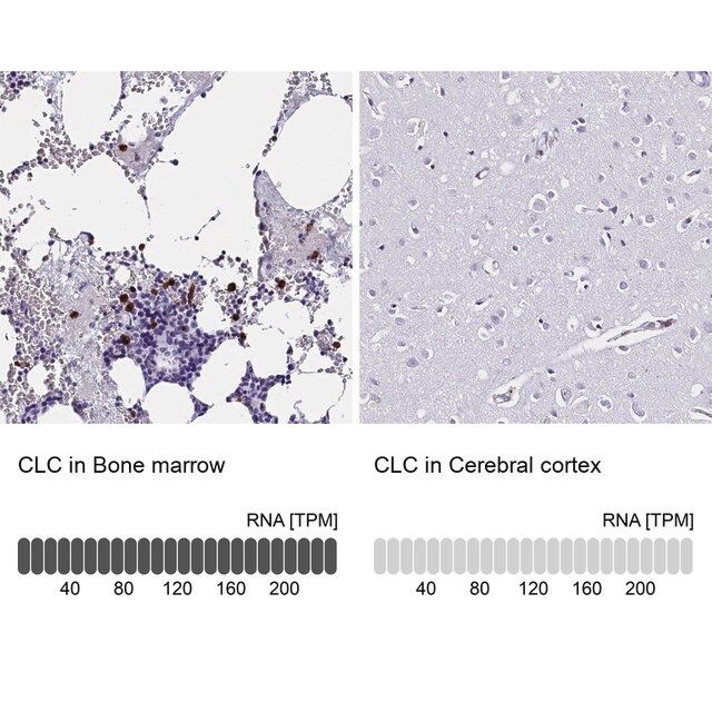 Anti-CLC antibody produced in rabbit