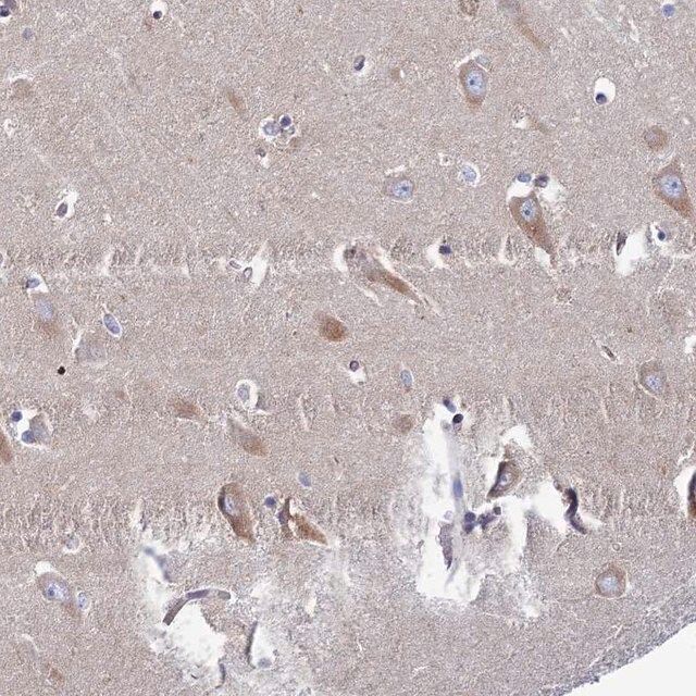 Anti-CLCN3 antibody produced in rabbit