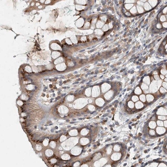 Anti-CLCN2 antibody produced in rabbit