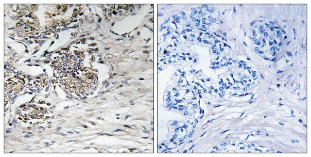 Anti-Claudin 7 antibody produced in rabbit