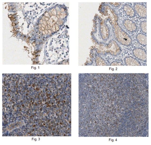 Anti-Claudin-4 Antibody, clone 10B4.3