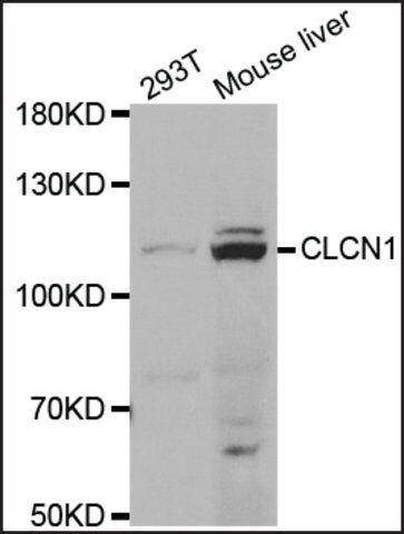 Anti-CLCN1 antibody produced in rabbit