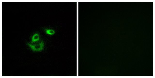 Anti-CLCC1 antibody produced in rabbit