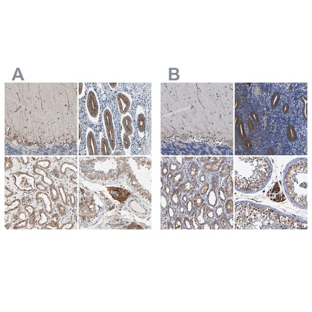 Anti-CLCC1 antibody produced in rabbit