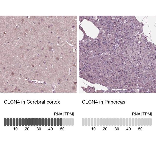 Anti-CLCN4 antibody produced in rabbit