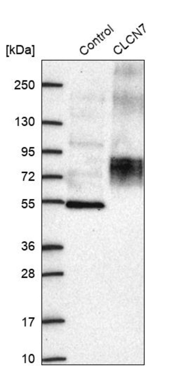 Anti-CLCN7 antibody produced in rabbit