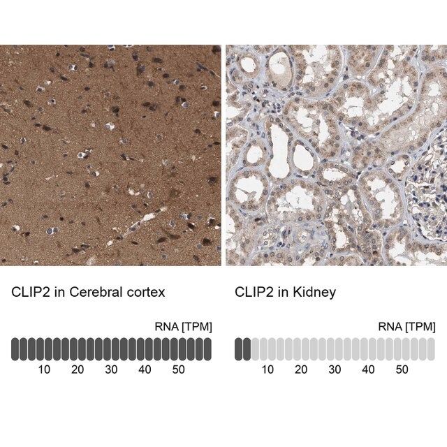 Anti-CLIP2 antibody produced in rabbit