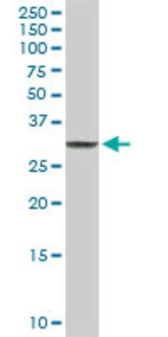 Anti-CLIC3 antibody produced in rabbit