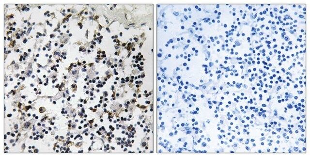 Anti-CLIC4 antibody produced in rabbit