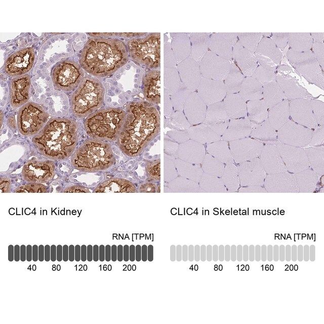 Anti-CLIC4 antibody produced in rabbit