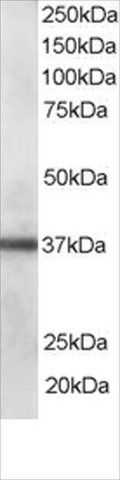 Anti-CLIM1/PDLIM1 antibody produced in goat