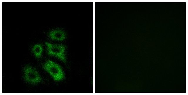 Anti-CLIP3 antibody produced in rabbit