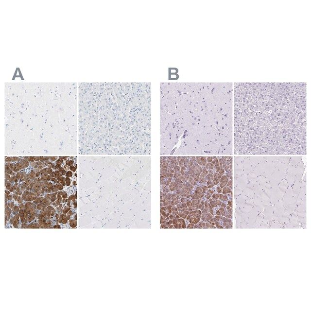 Anti-CEL antibody produced in rabbit