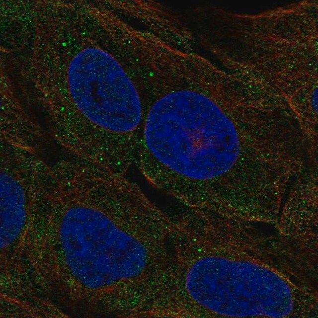 Anti-CELA3A antibody produced in rabbit