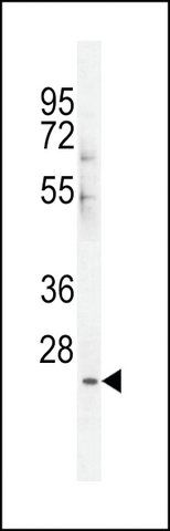 ANTI-CES4(N-TERMINAL) antibody produced in rabbit