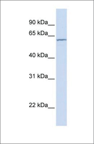 Anti-CES7 (ab1) antibody produced in rabbit