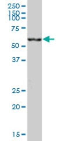 Anti-CES2 antibody produced in mouse