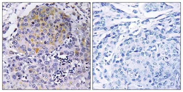 Anti-CEP78 antibody produced in rabbit