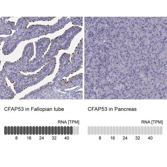 Anti-CFAP53