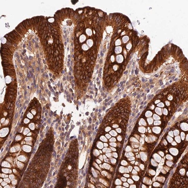 Anti-CES3 antibody produced in rabbit