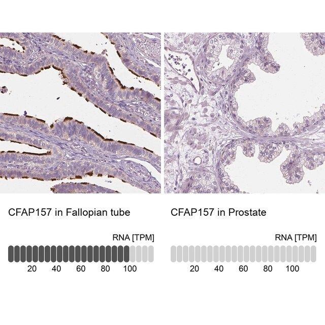 Anti-CFAP157 antibody produced in rabbit