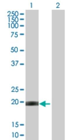 Anti-CETN1 antibody produced in mouse